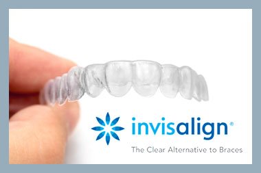 How Invisible Is Invisalign?