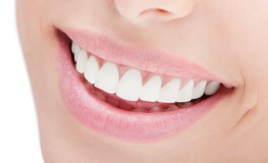 Invisalign Preparation Tips | Tribeca Dental Care