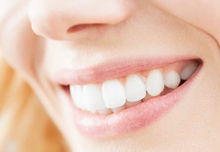 Bright smile from teeth whitening