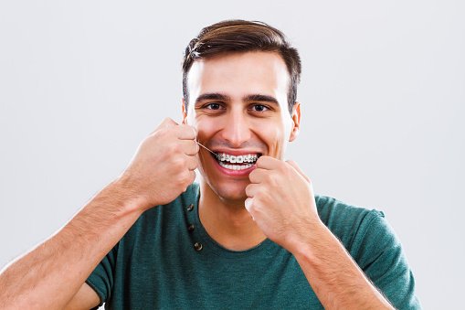 Dental hygiene for braces