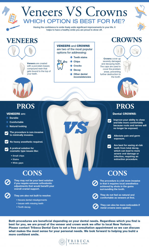veneers-vs-crowns-Tribecany Dentist Office