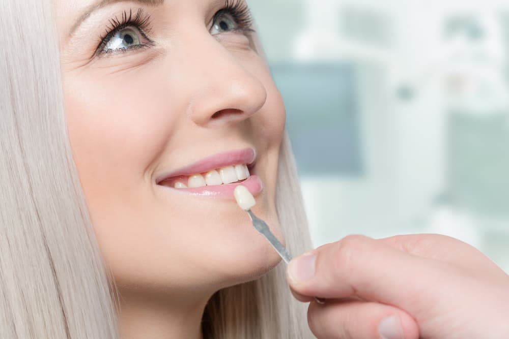 Are Porcelain Veneers Right for You? | Tribeca Dental Care